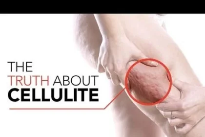 Cellulogia: The Holistic Approach to Skin Wellness and Cellulite Reduction