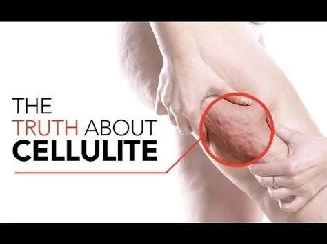 Cellulogia: The Holistic Approach to Skin Wellness and Cellulite Reduction