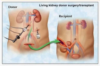 Dayalases: Understanding Dialysis, Its Importance, and Impact on Health